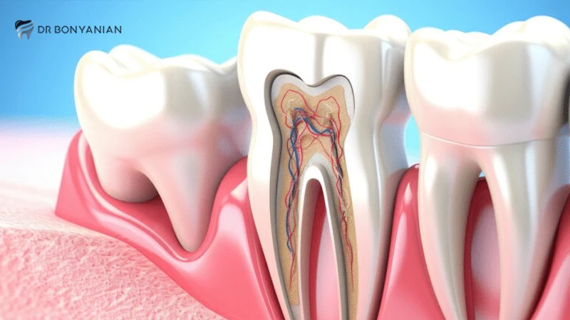 عمر دندان عصب کشی شده
