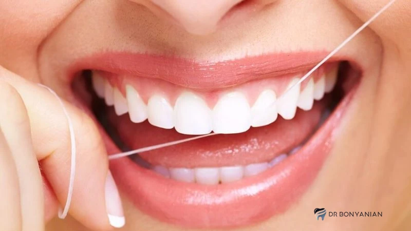 تا چند ساعت بعد از کامپوزیت نباید چیزی خورد