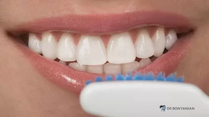 مراقبت های بعد از کامپوزیت دندان