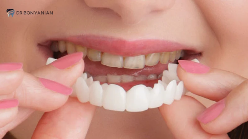 دندان عصب کشی شده چقدر عمر میکند