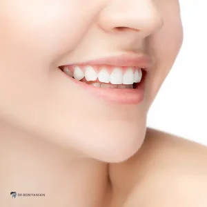 دلایل اهمیت مراقبت از کامپوزیت دندان