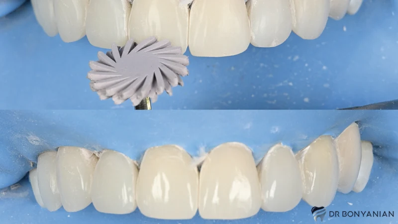 پالیش کامپوزیت چیست