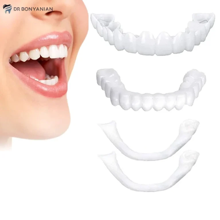 همه چیز درباره لمینت متحرک دندان