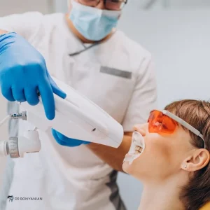 مراقبت های بعد از بلیچینگ دندان