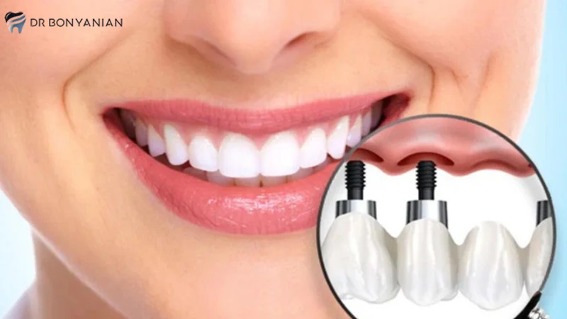 چه دندانی نیاز به کشیدن دارد