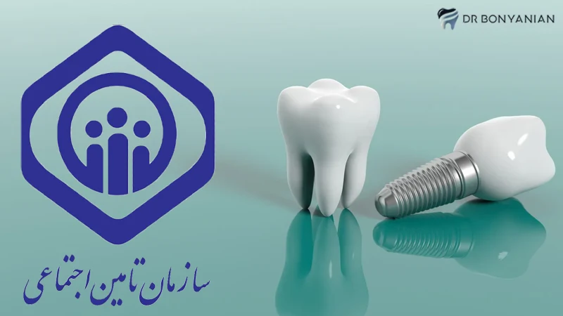 Dental implant cost with Social Security insurance