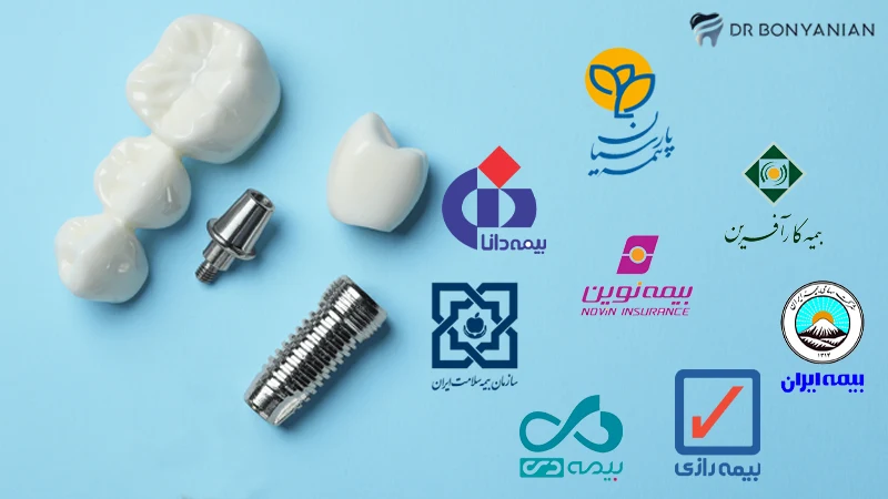 Dental implant covered by supplementary insurance
