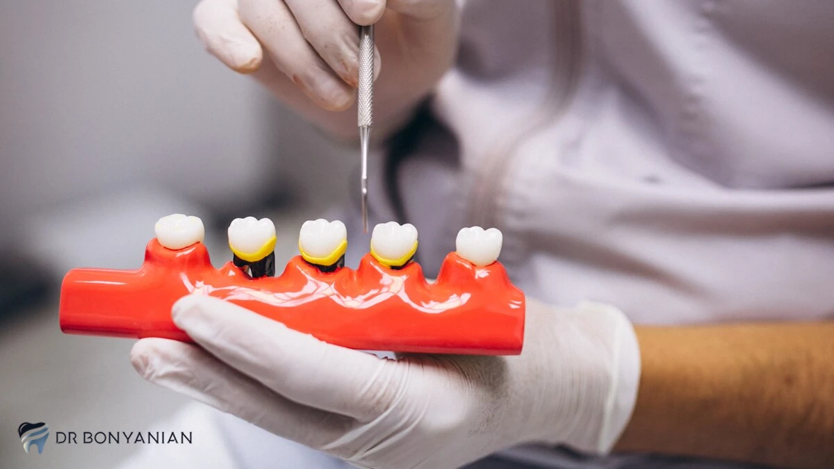 پروتز دندان