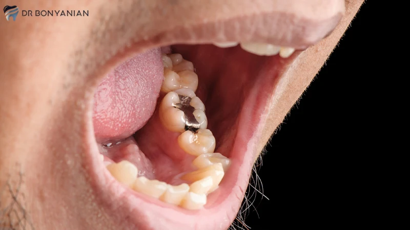 مواد پرکننده