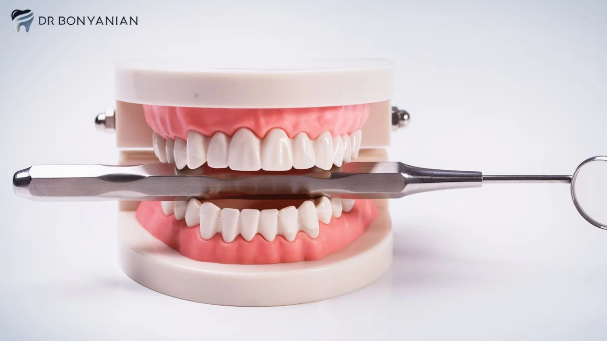 پروتزهای دندانی متحرک