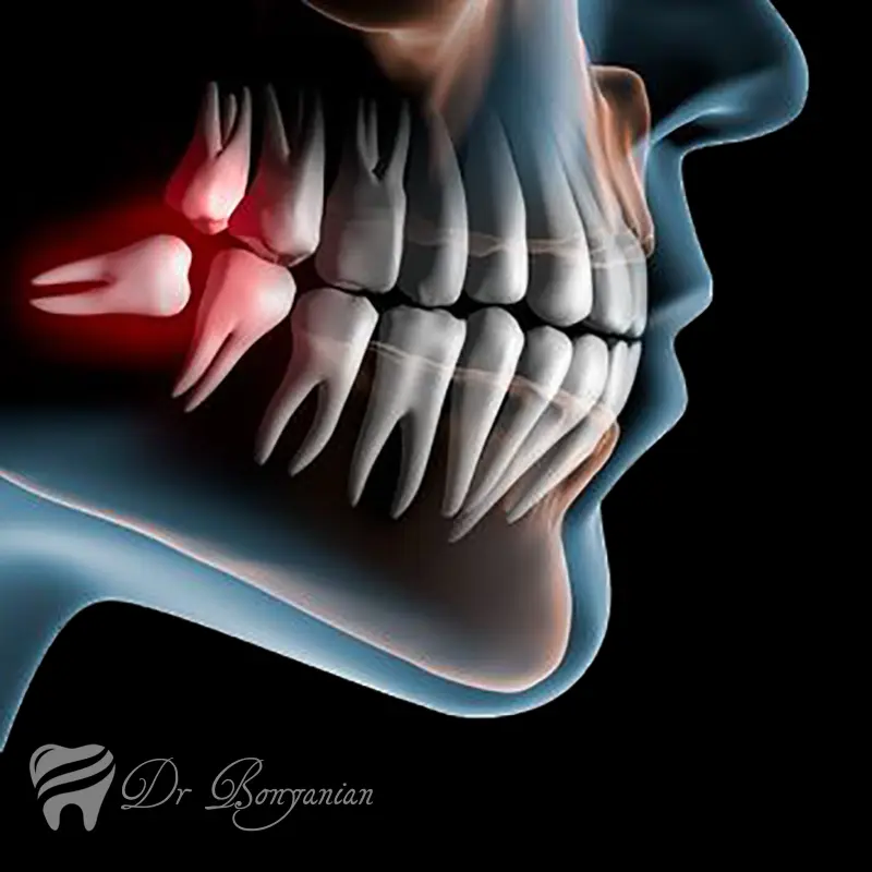 drbonyanian-oral-surgery