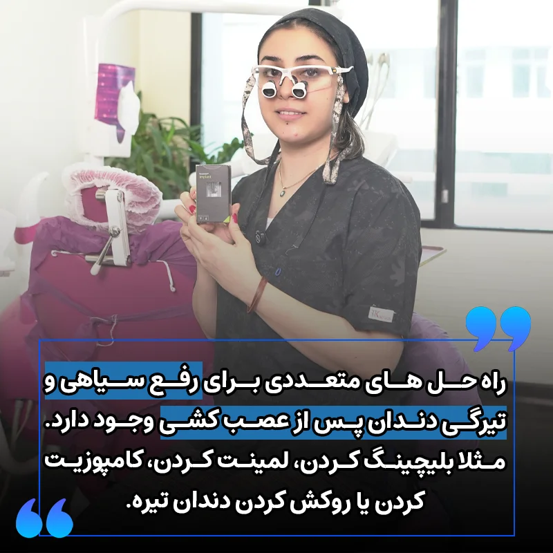 رفع سیاهی و تیرگی دندان پس از عصب کشی