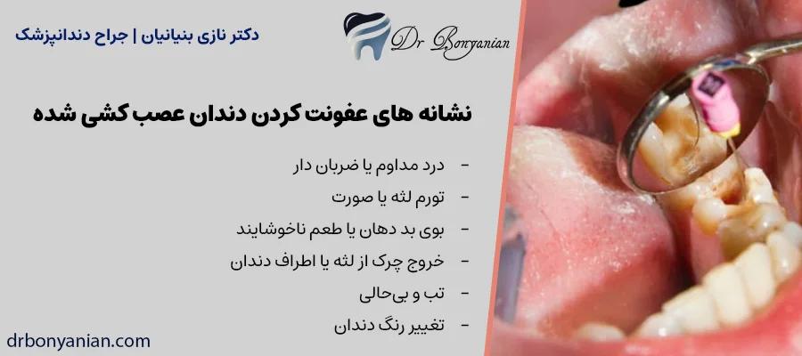 نشانه های عفونت کردن دندان عصب کشی شده