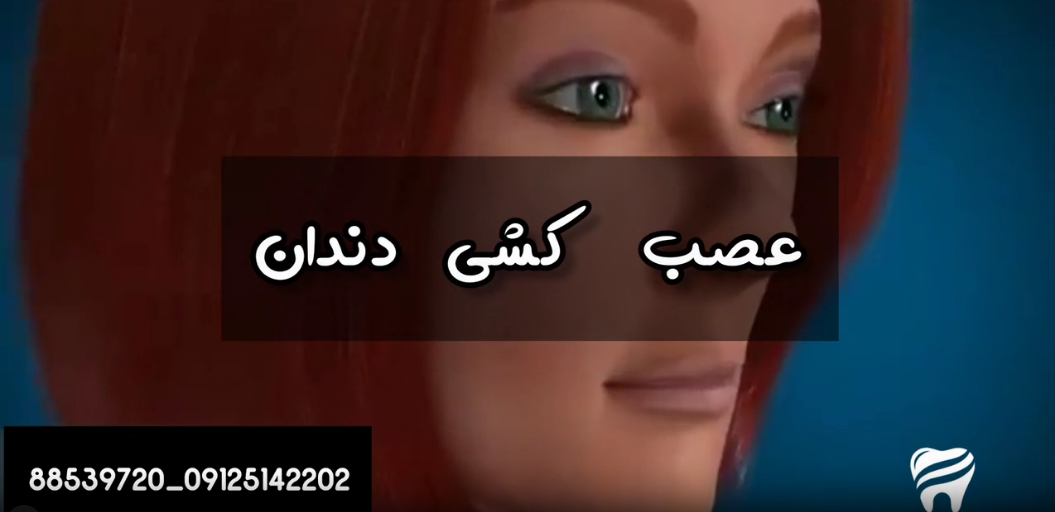 فیلم مراحل عصب کشی دندان