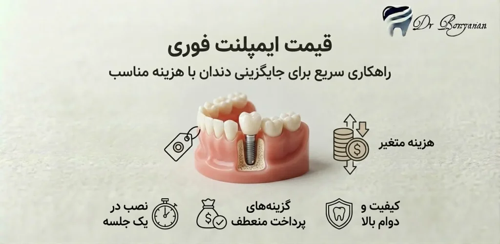 قیمت ایمپلنت فوری دندان