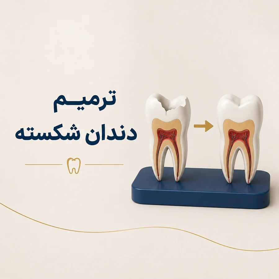 ترمیم دندان شکسته