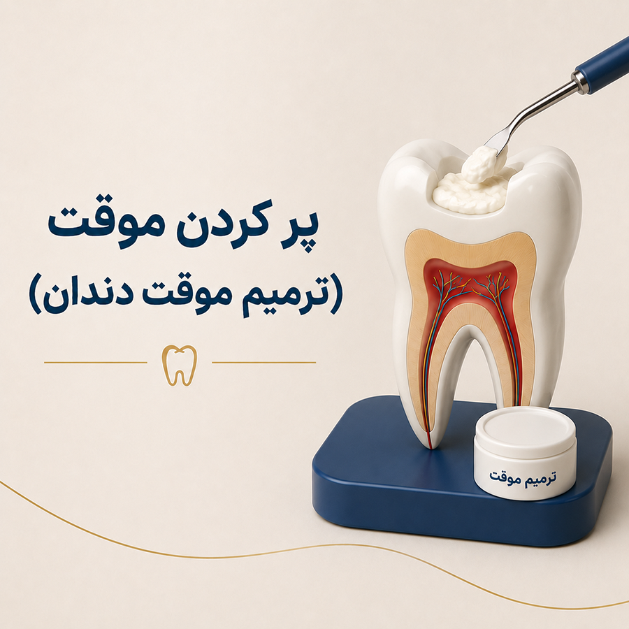 پر کردن موقت (ترمیم موقت دندان)