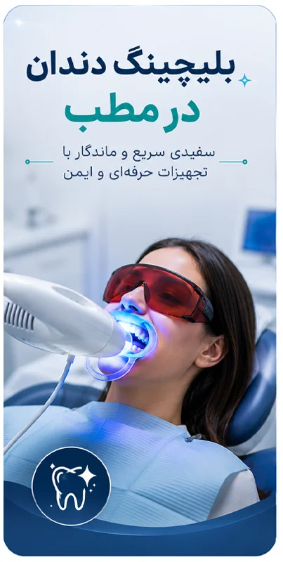 سفید کردن دندان ها در مطب دندانپزشکی