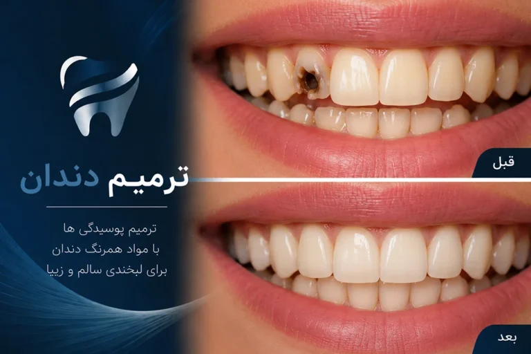 ترمیم دندان در دندانپزشکی دکتر بنیانیان