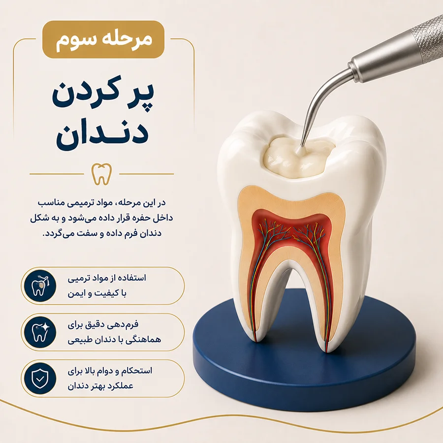 مرحله سوم ترمیم دندان