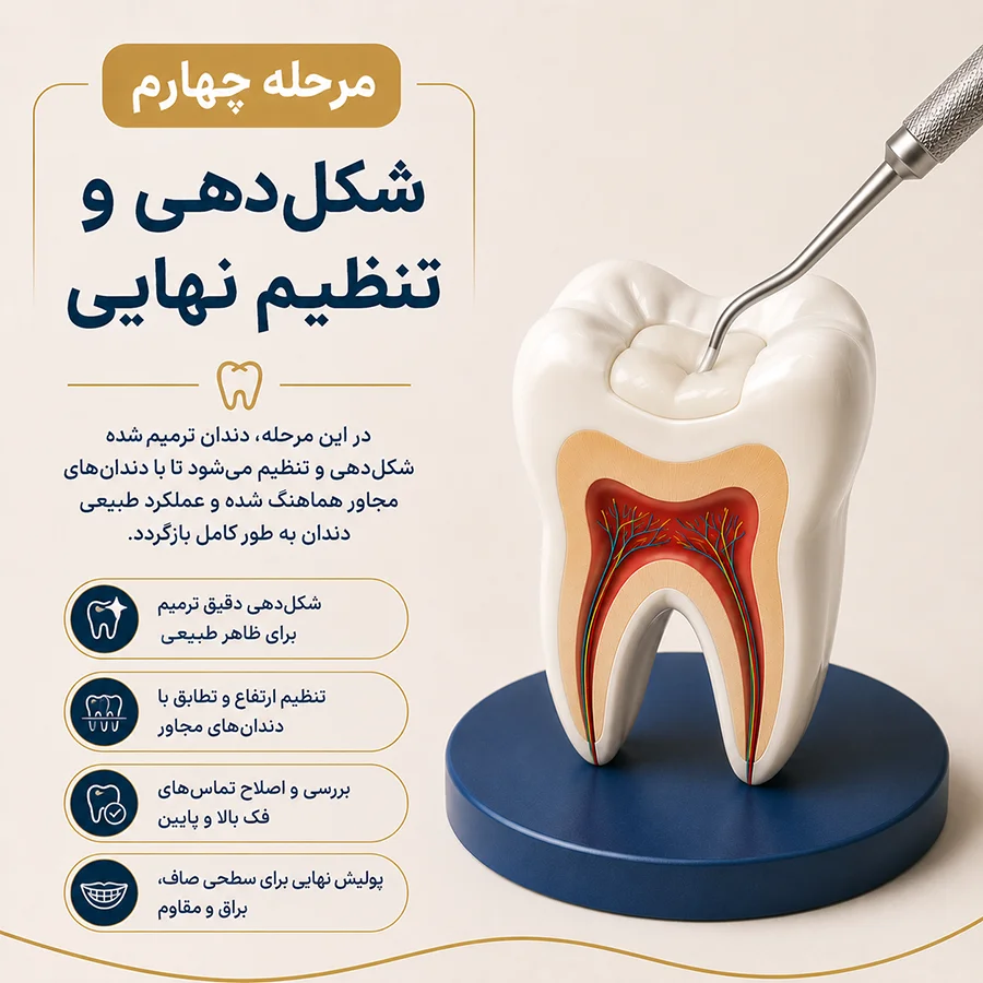 مرحله چهارم ترمیم دندان
