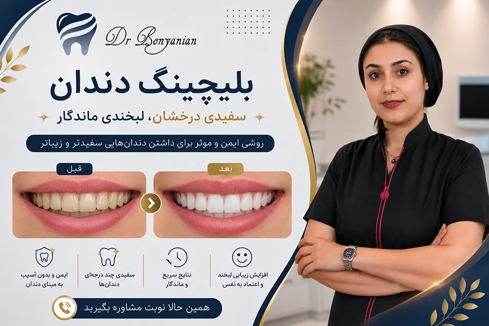 خدمات بلیچینگ دندان در تهران