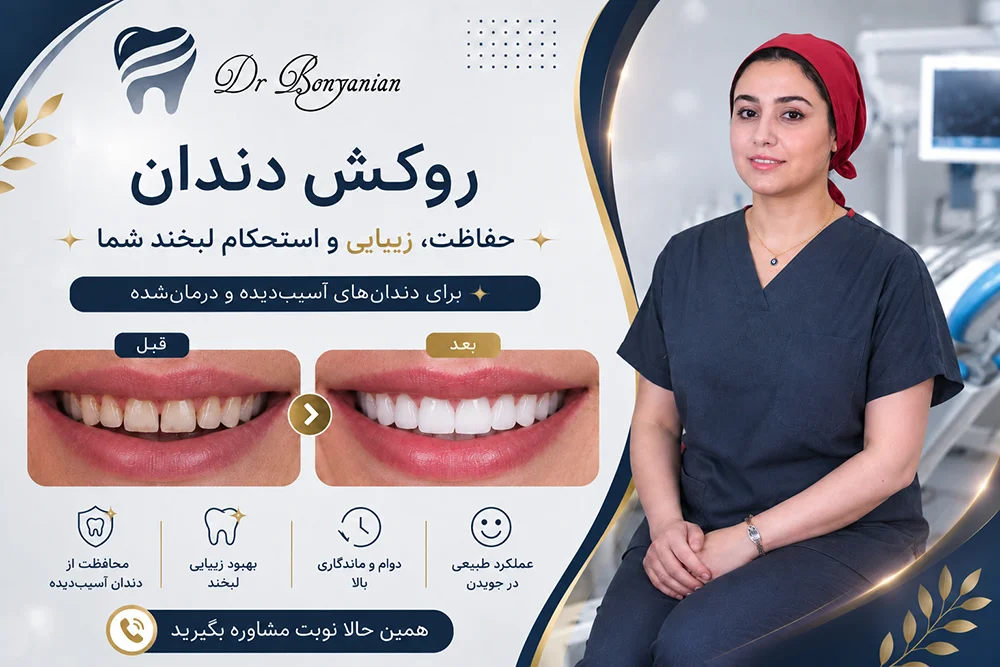 خدمات روکش دندان در تهران