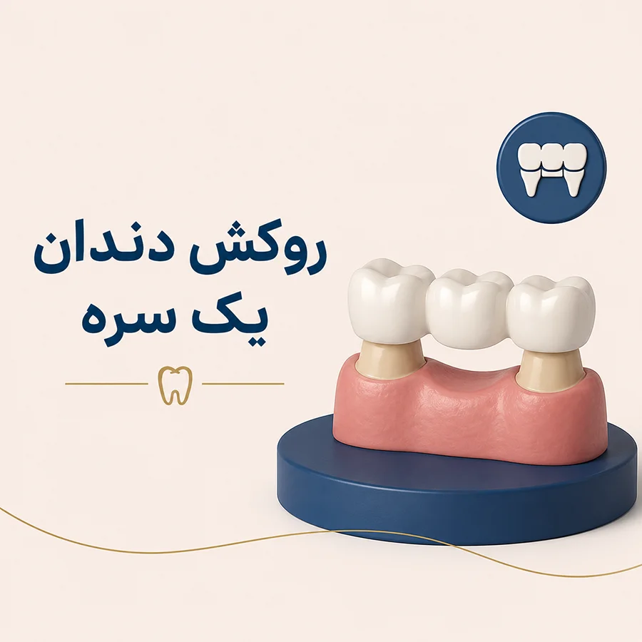 روکش دندان یک سره