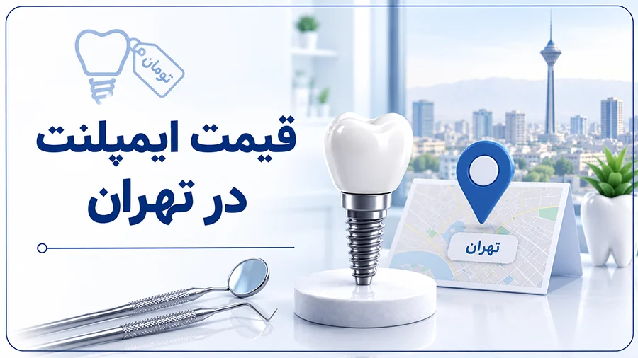 قیمت ایمپلنت دندان در تهران