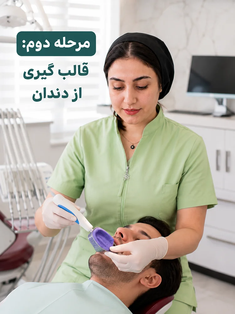 مرحله دوم ساخت روکش دندان