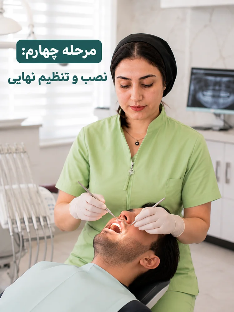 مرحله چهارم ساخت روکش دندان