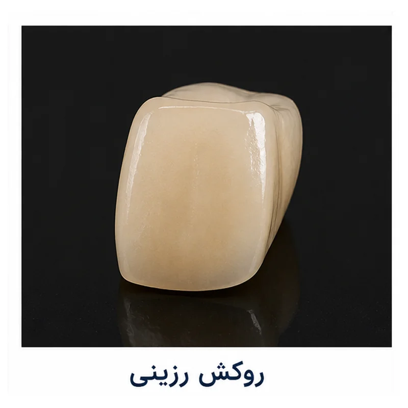 معرفی روکش رزینی