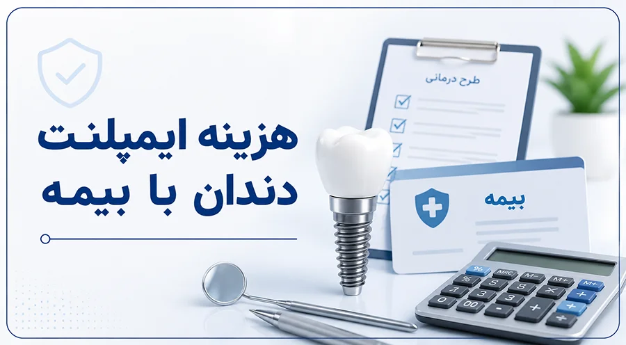 هزینه ایمپلنت دندان با بیمه