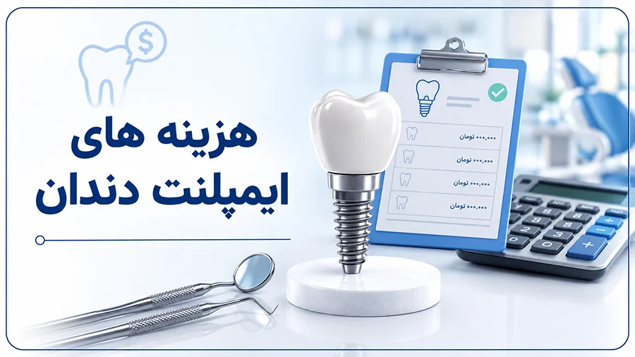 هزینه ایمپلنت دندان در تهران