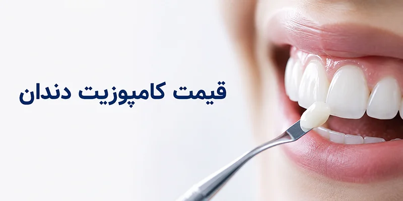 قیمت کامپوزیت دندان